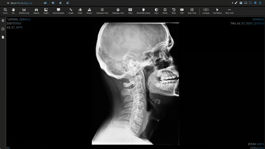 Lateral Cervical Toolset