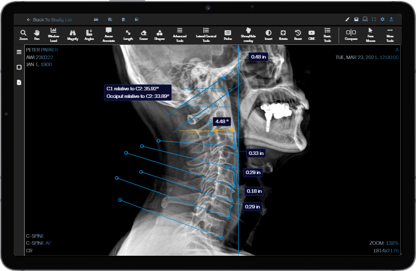 LateralCervical